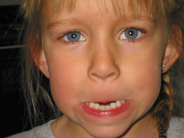 Carrie making a mad face.  See how big the two middle bottom teeth have gotten?