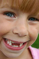 Carrie missing teeth :)